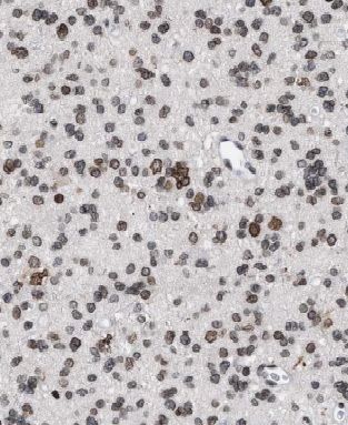 CYFIP2 Antibody - BSA Free
