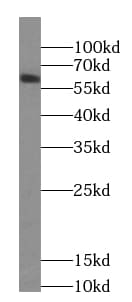 CCDC86 Antibody - BSA Free