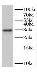 Cyclin G Antibody - BSA Free