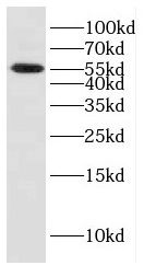 CYB5R4 Antibody - BSA Free