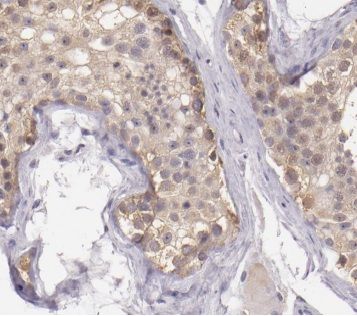 Cytochrome b5 Outer Mitochondrial Membrane Antibody - BSA Free