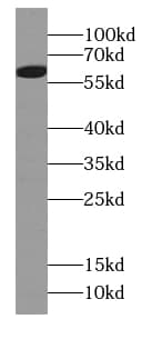 taxilin gamma Antibody - BSA Free