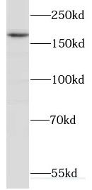 Cullin-7 Antibody - BSA Free