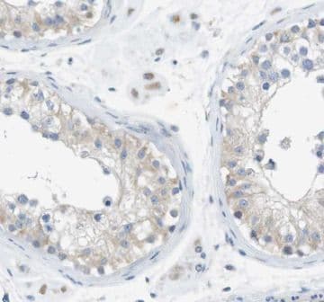 CTTNBP2 Antibody - BSA Free