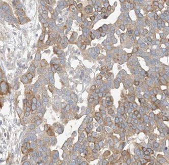 CTDSPL2 Antibody - BSA Free
