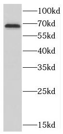 CTDSPL2 Antibody - BSA Free