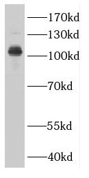 CTAGE5 Antibody - BSA Free