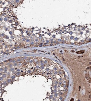 CSTL1 Antibody - BSA Free