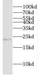 CRYBA2 Antibody - BSA Free