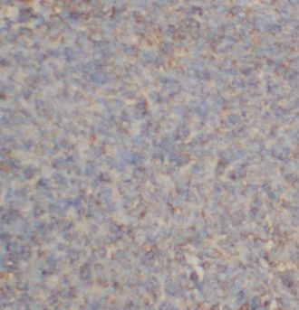 CSTP1 Antibody - BSA Free