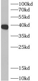 ADPRHL2 Antibody - BSA Free