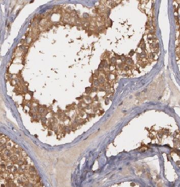 ADPRHL2 Antibody - BSA Free