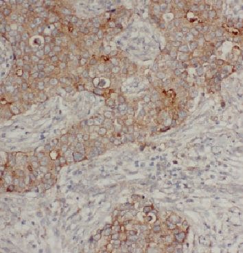 ARF4 Antibody - BSA Free