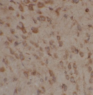 AP3M2 Antibody - BSA Free