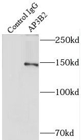 AP3B2 Antibody - BSA Free