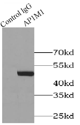 AP1M1 Antibody - BSA Free