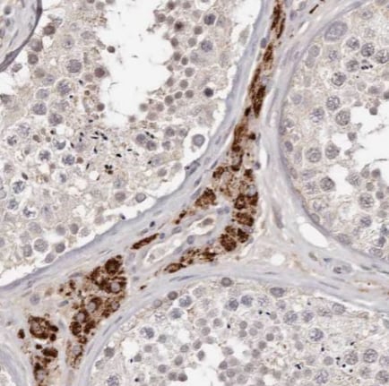 TMEM16K Antibody - BSA Free