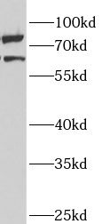 ANKS3 Antibody - BSA Free
