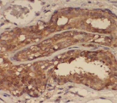 ANKS3 Antibody - BSA Free