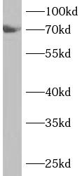 ANKS1B Antibody - BSA Free