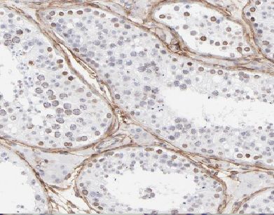 ANKS1B Antibody - BSA Free