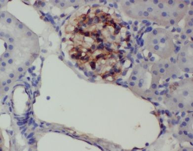 ANKRD6 Antibody - BSA Free