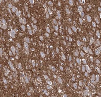 ANKRD57 Antibody - BSA Free