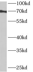 ANKRD55 Antibody - BSA Free
