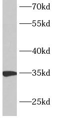 ANKRD54 Antibody - BSA Free