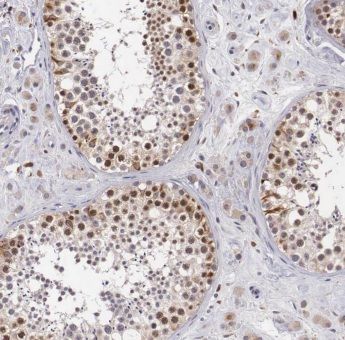 ANKRD54 Antibody - BSA Free