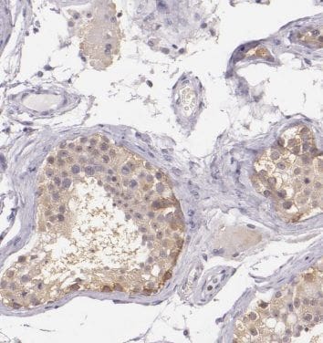 ANKRD53 Antibody - BSA Free