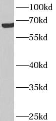 ANKRD53 Antibody - BSA Free
