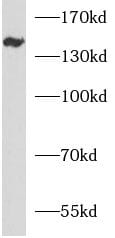 ANKRD50 Antibody - BSA Free