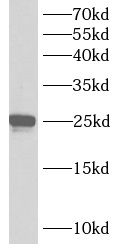 Ankyrin repeat domain 39 Antibody - BSA Free
