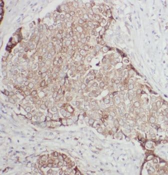 ANKRD26 Antibody - BSA Free