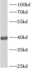 ANKRD2 Antibody - BSA Free