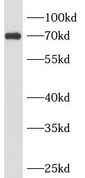 ANKRD13B Antibody - BSA Free