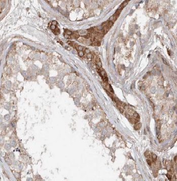 ANKRD13B Antibody - BSA Free
