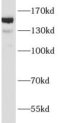 ANKRD11 Antibody - BSA Free