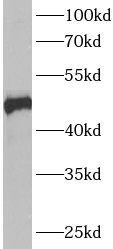 ANKMY2 Antibody - BSA Free