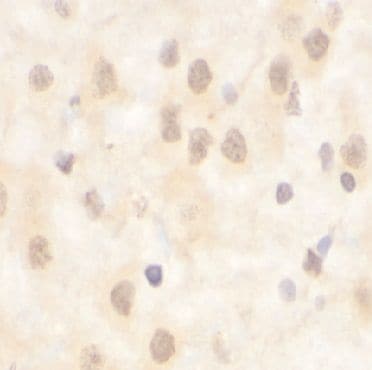 LEM3 Antibody - BSA Free