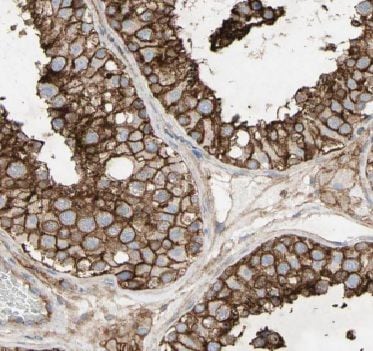Archaemetzincin 2 Antibody - BSA Free