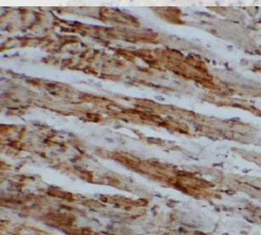 archaemetzincin-1 Antibody - BSA Free