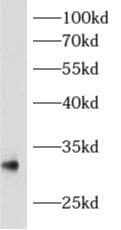 archaemetzincin-1 Antibody - BSA Free
