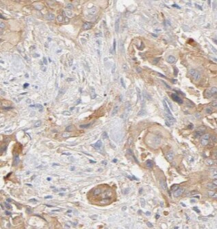 Pancreatic Amylase Beta Antibody - BSA Free