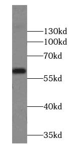 Pancreatic Amylase Beta Antibody - BSA Free