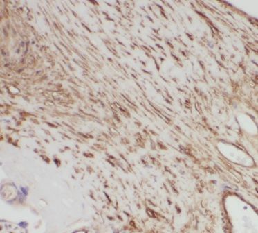 PRKAG2 Antibody - BSA Free