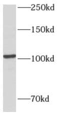 AMPD2 Antibody - BSA Free