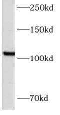 Angiomotin like 1 Antibody - BSA Free