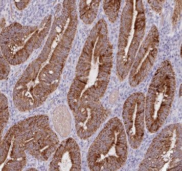 AMN1 Antibody - BSA Free